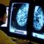 Tewkesbury Admag: Breast cancer charities are encouraging more women to go for screening Tewkesbury Admag: Breast cancer charities are encouraging more women to go for screening